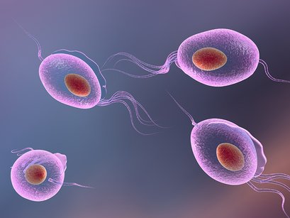 A trichomoniasis - Paraziták kezelése terhes nőkben - Trichomonas és Giardia