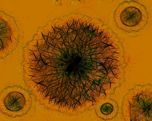 HEV Virus diagnosis