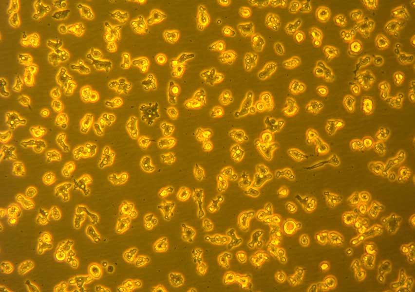 Acanthamoeba castellanii