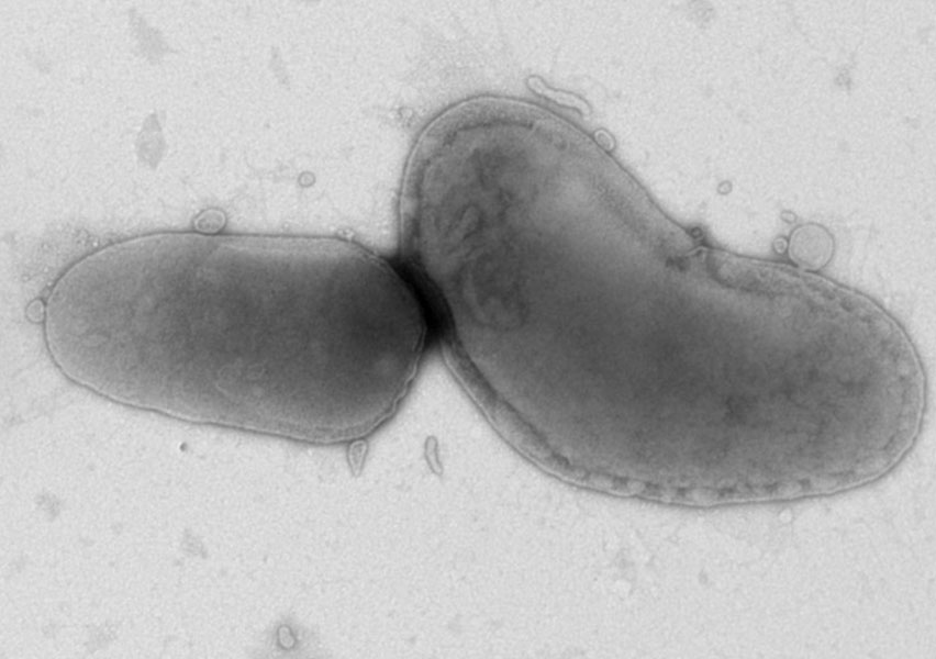 Bartonella henselae