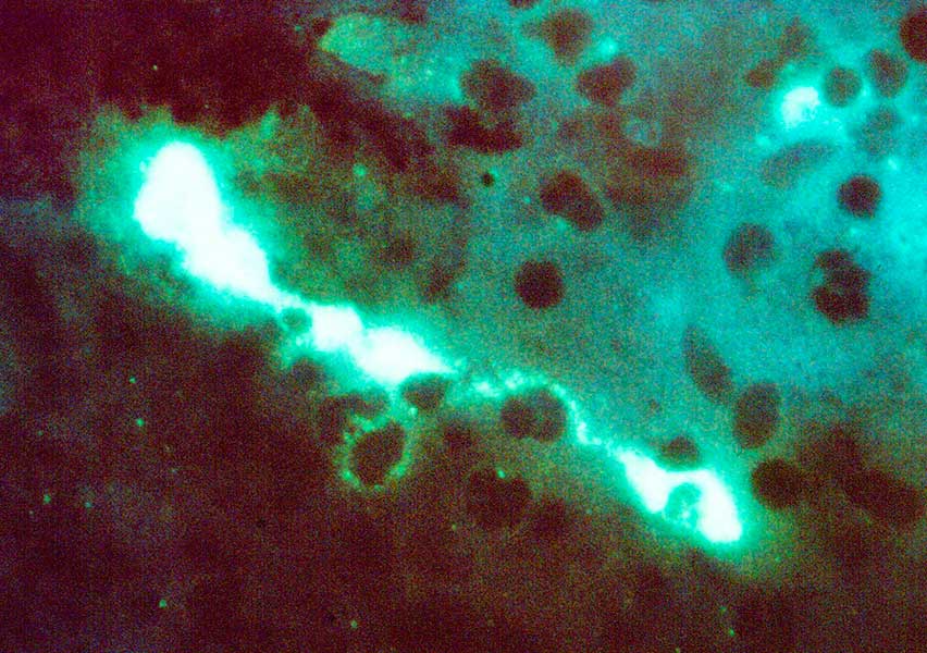 Chlamydia psittaci