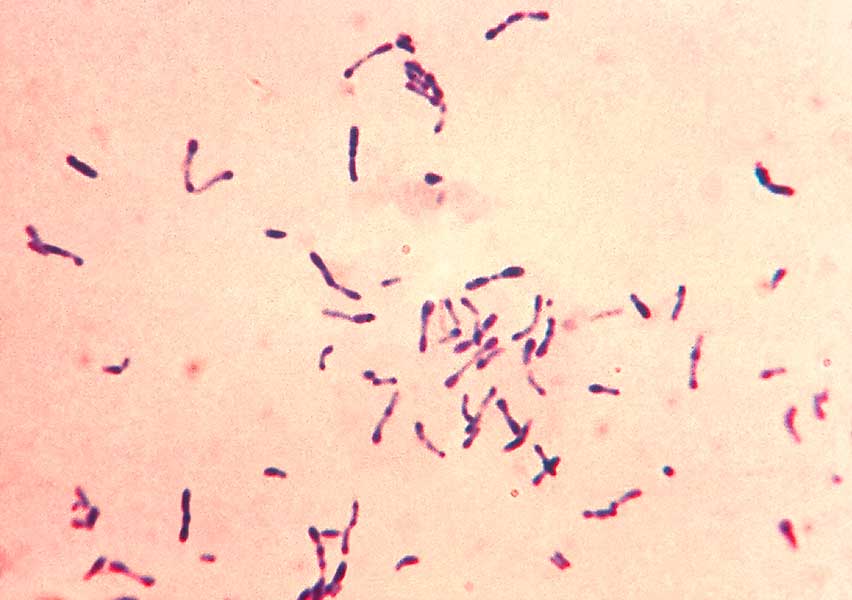 corynebacterium diphteriae