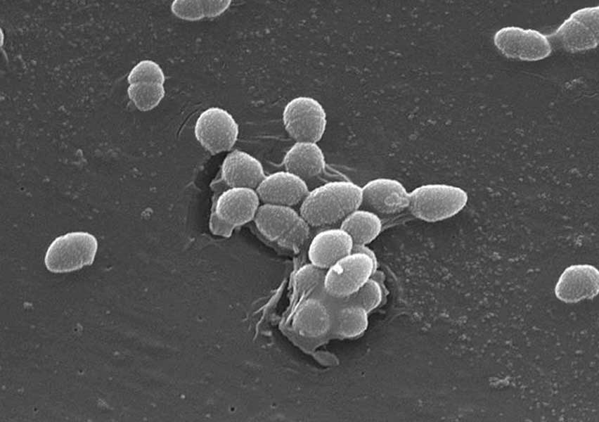 Enterococcus faecalis