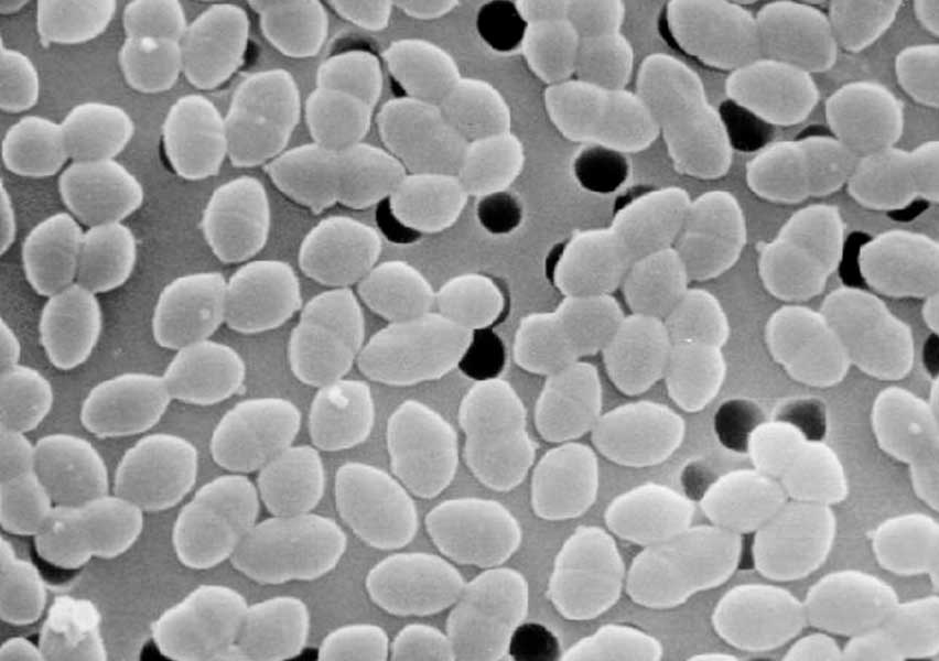 Enterococcus faecium