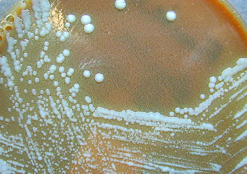 Francisella tularensis