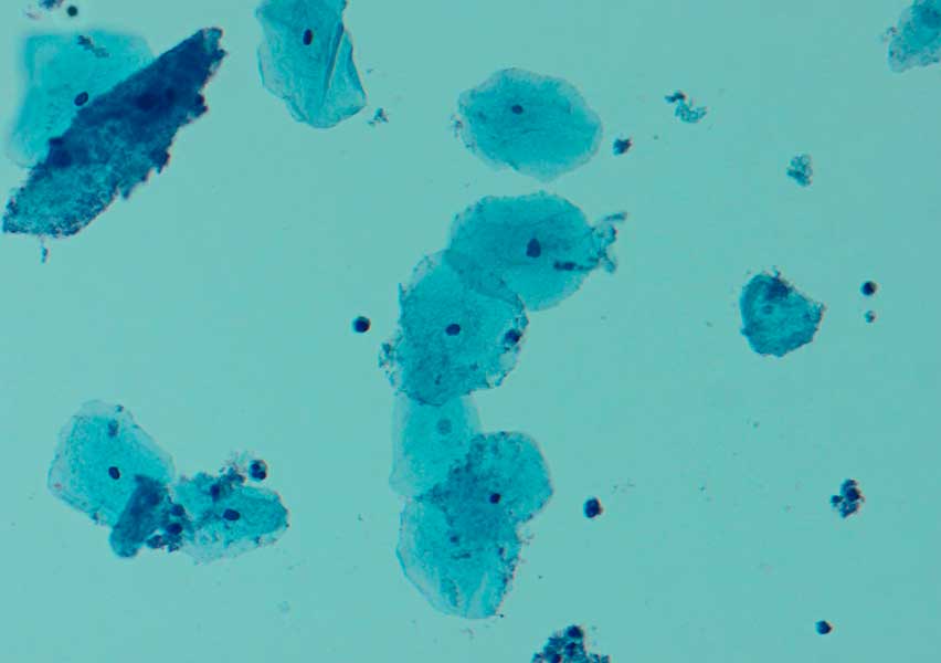 Gardnerella vaginalis