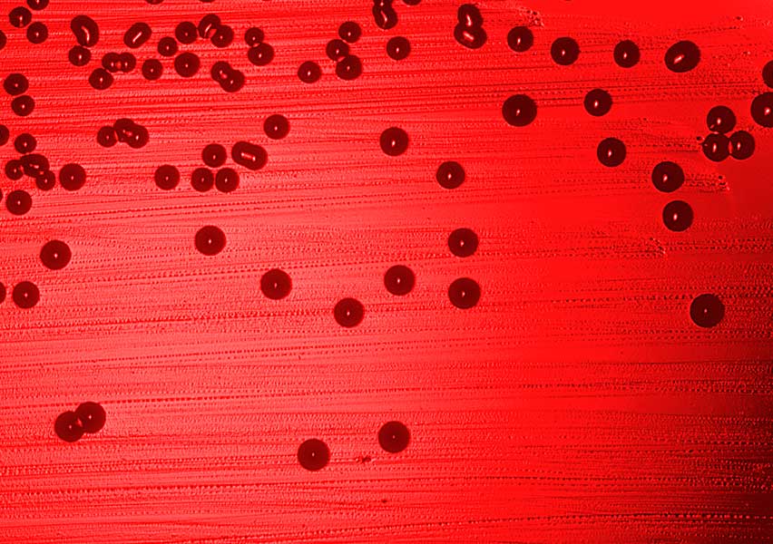 Haemophilus influenzae