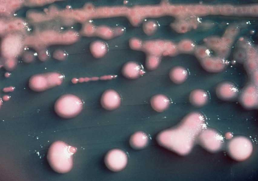 klebsiella pneumoniae