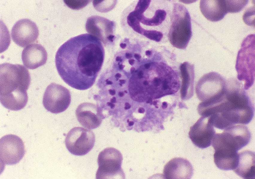Leishmania infantum