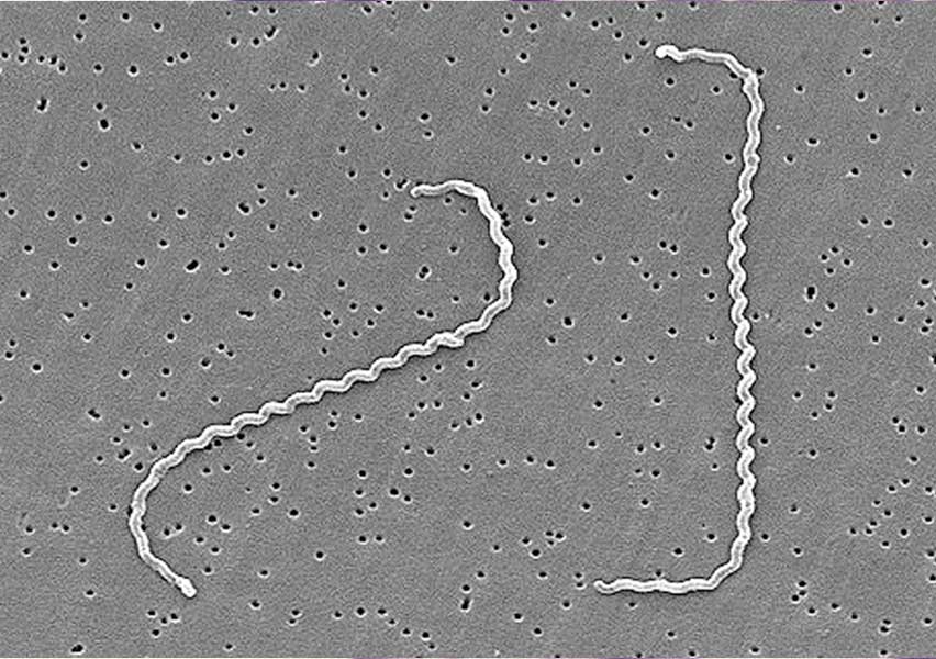 leptospira