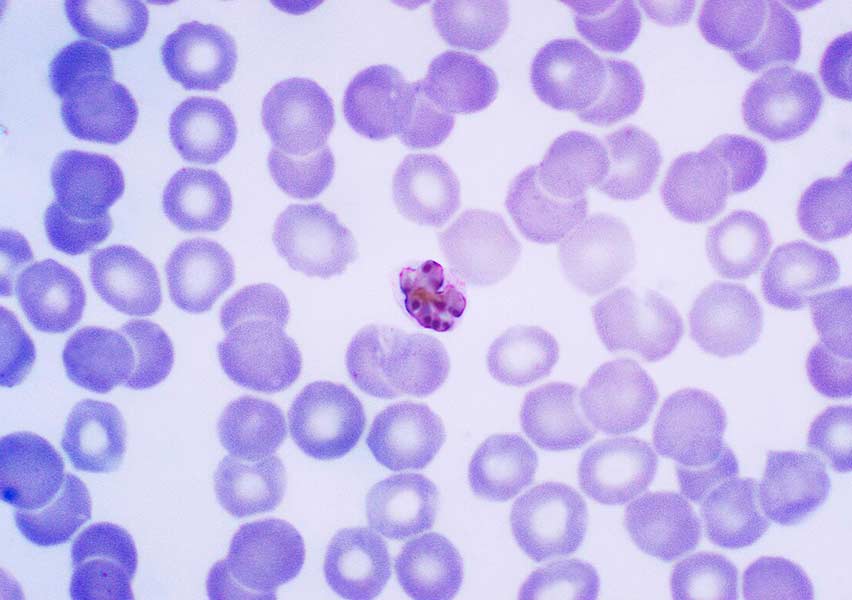 Plasmodium