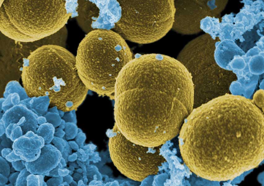 Staphylococcus aureus