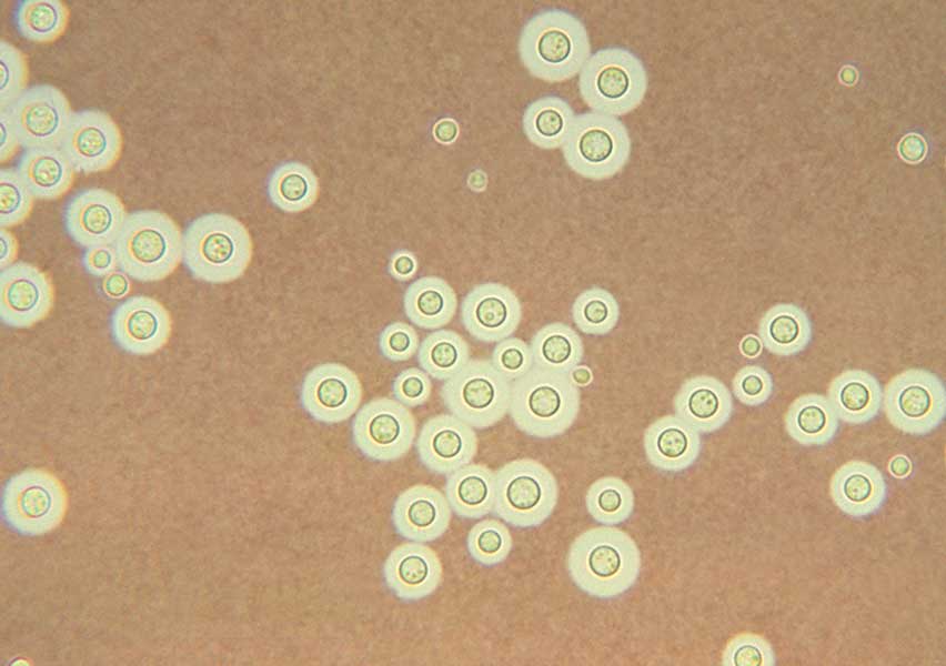 cryptococcus neoformans