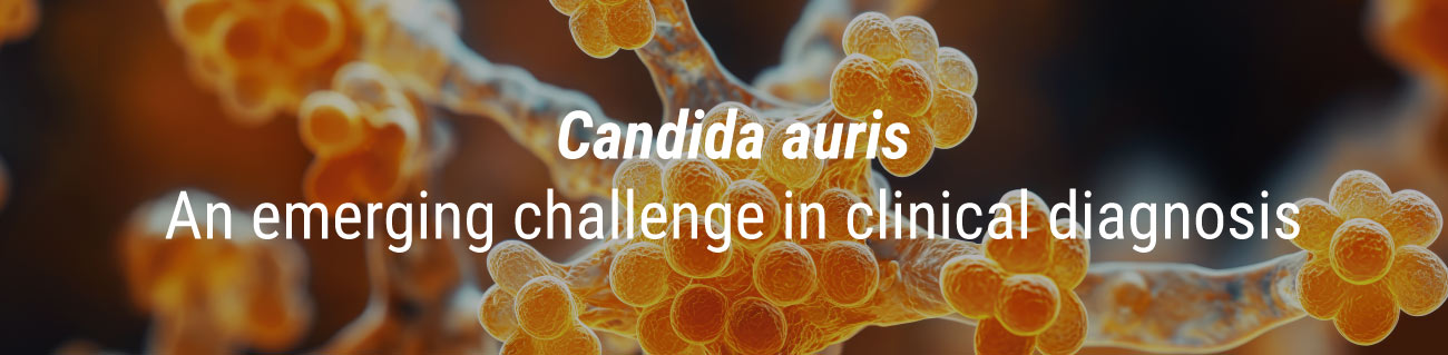 candida auris diagnosis