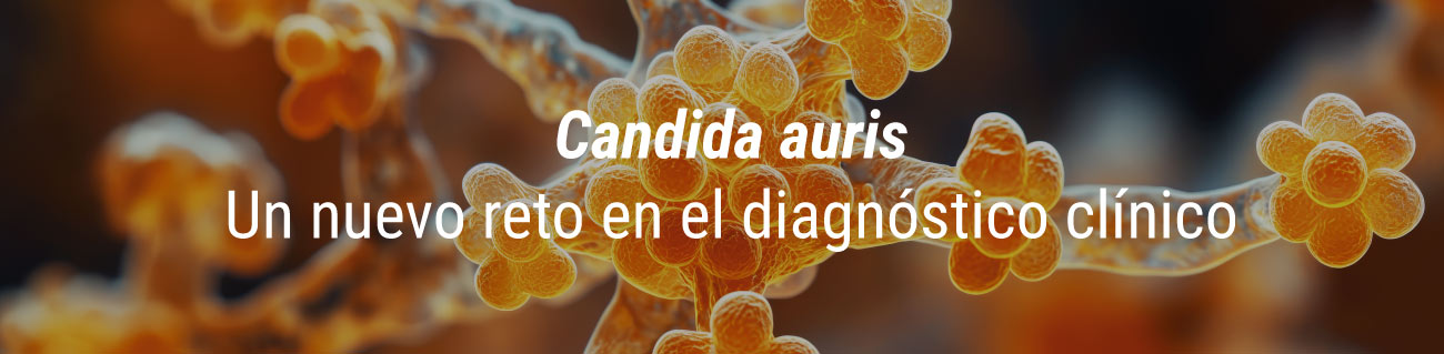 DIAGNOSTICO CANDIDA AURIS