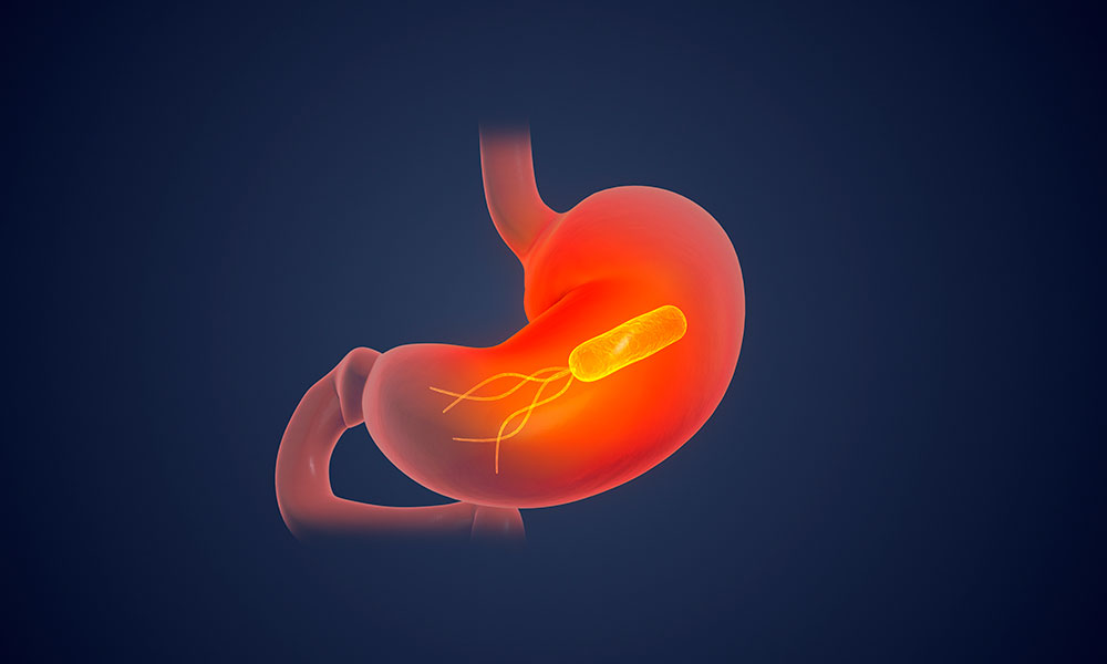 helicobacter pylori stool antigen