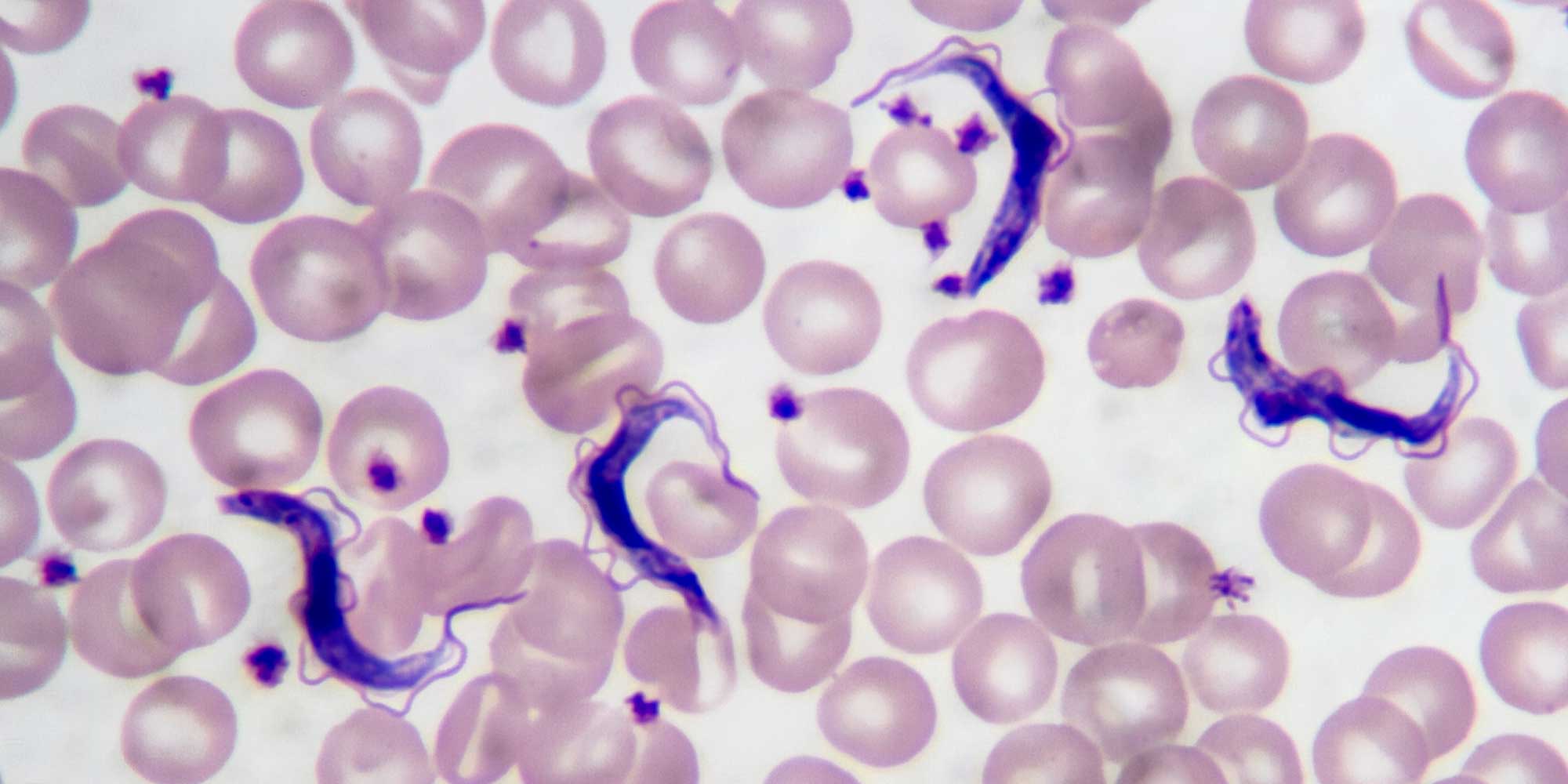 chagas disease endemic regions