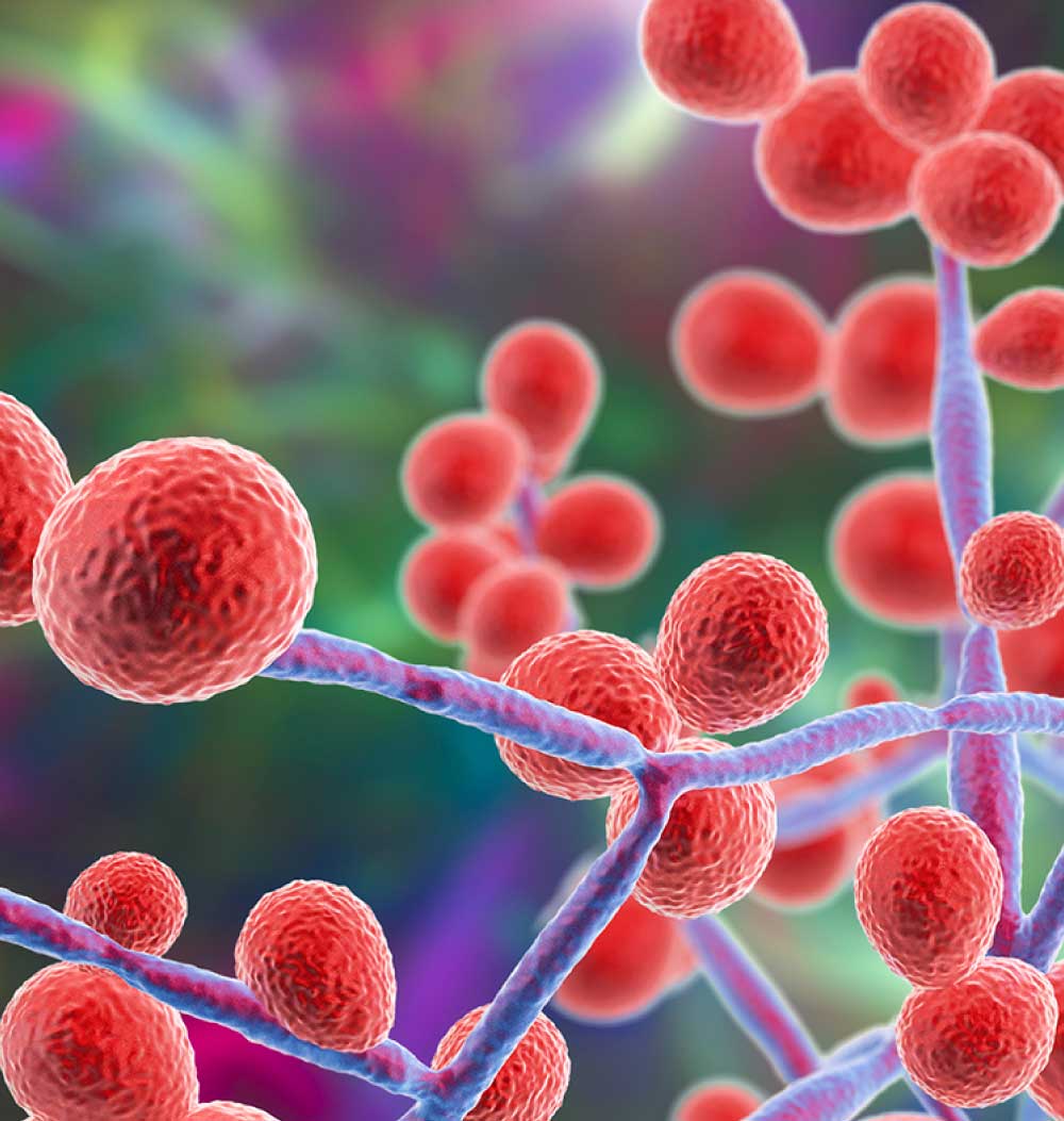 candidiasis molecular solution