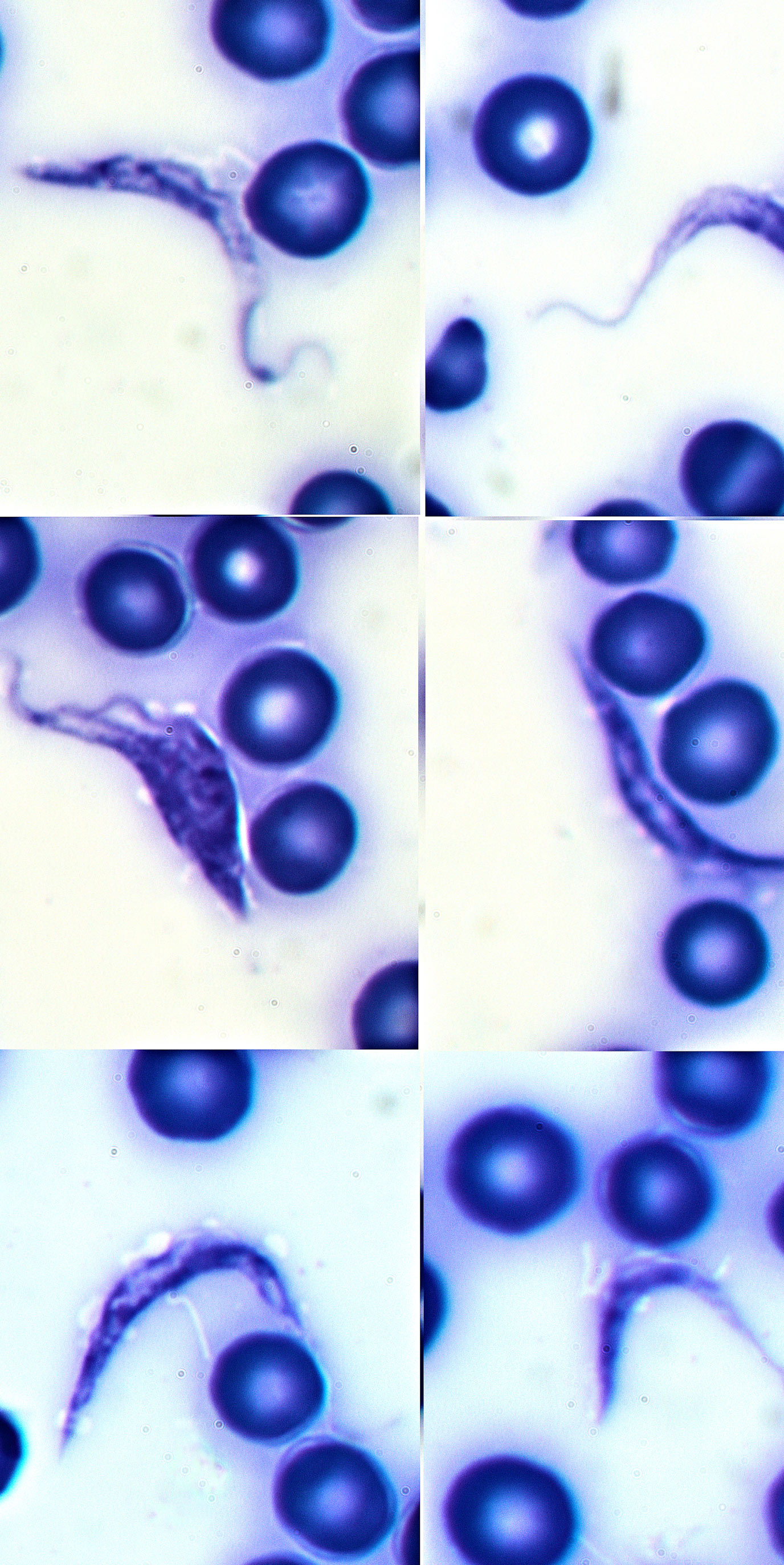 chagas diagnostic
