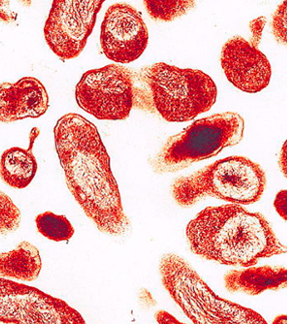 coxiella burnetii
