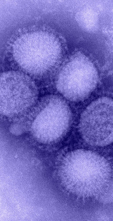 epidemic influenza 2025