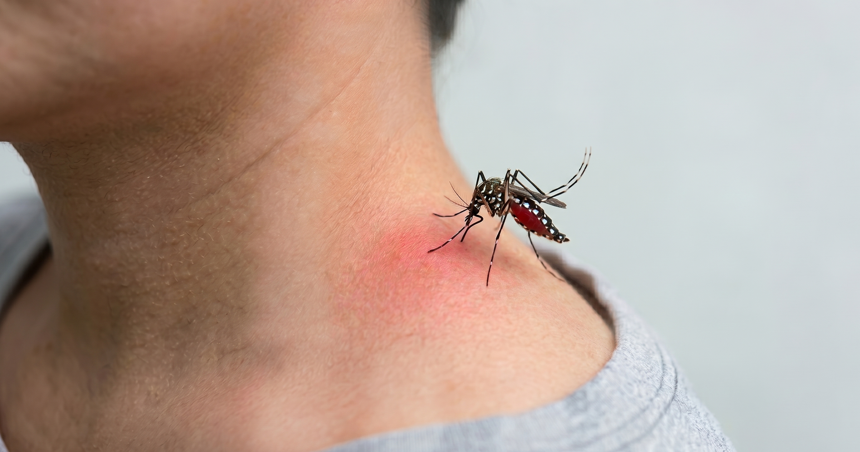 Dengue bite