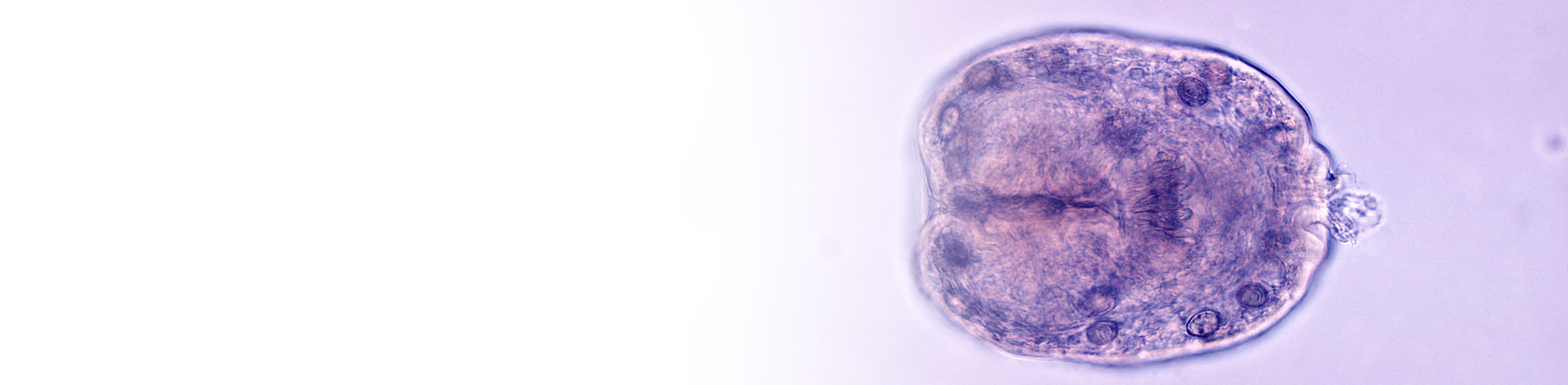 echinococcus granulosus