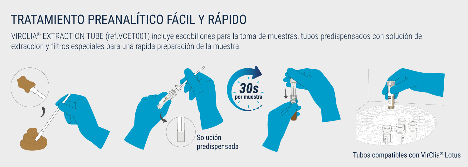 tratamiento preanalitico helicobacter pylori
