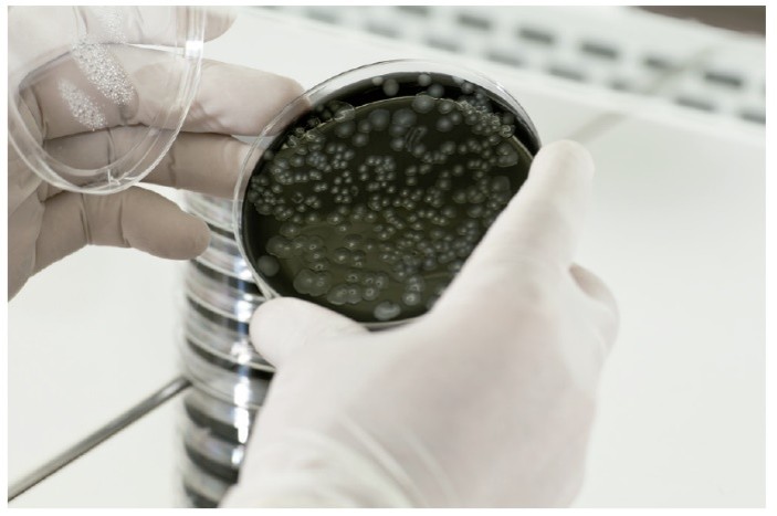 cultivo de legionella