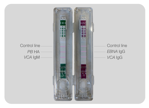 kit virapid para mononucleosis