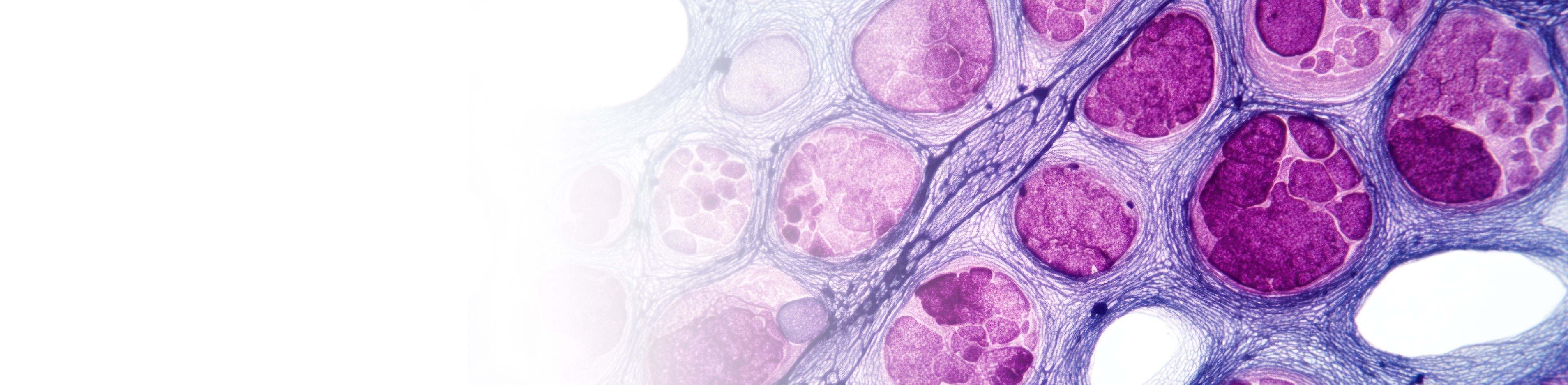 pneumocystis jirovecii pcr diagnosis