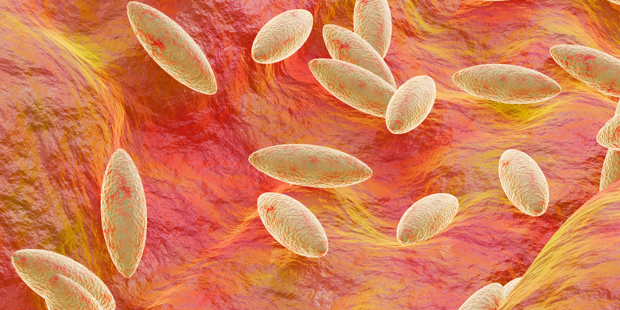 brucellosis serology solutions