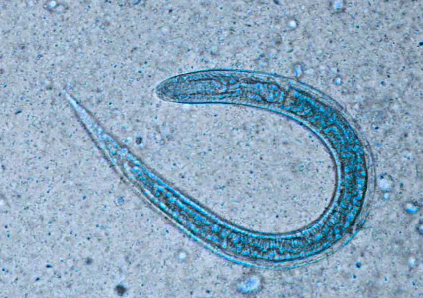 strongyloides stercoralis vircell