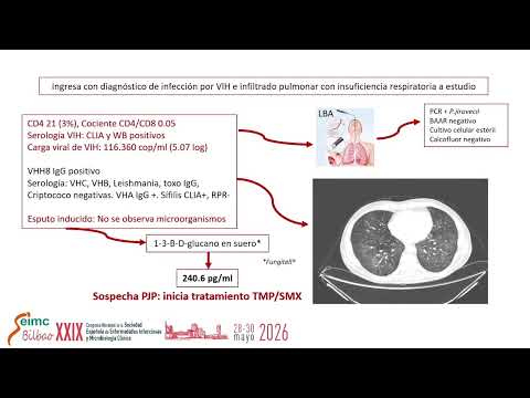 Biomarcadores en infección fúngica invasiva: de los datos epidemiológicos a la práctica clínica | Marina Machado Vílchez | Simposio Vircell – SEIMC 2026