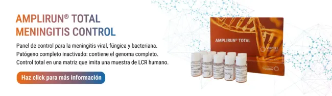 brote de meningitis en UK