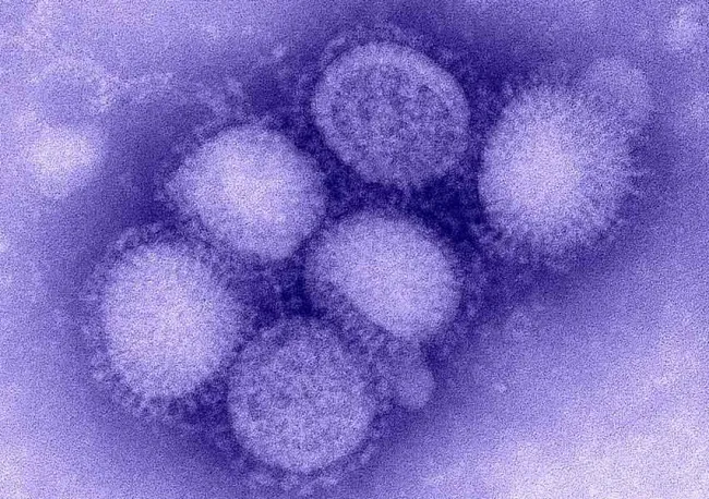 INFLUENZA A H1N1