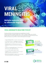 realtime_pcr_viral_meningitis_en_pme1150722.jpg